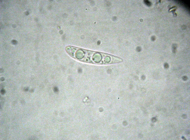 Forse non � Hymenoscyphus fructigenus ....